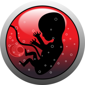 FETUS IN FETU: FETUS TRAPPED WITHIN FETUS